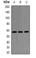 SHMT / SHMT2 Antibody - Western blot analysis of SHMT2 expression in HeLa (A); 22RV1 (B); mouse liver (C) whole cell lysates.