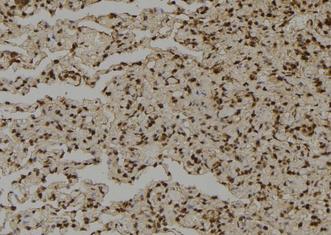 SHMT / SHMT2 Antibody - 1:100 staining human lung tissue by IHC-P. The sample was formaldehyde fixed and a heat mediated antigen retrieval step in citrate buffer was performed. The sample was then blocked and incubated with the antibody for 1.5 hours at 22°C. An HRP conjugated goat anti-rabbit antibody was used as the secondary.