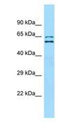SHOC2 Antibody - SHOC2 antibody Western Blot of Jurkat cell lysate.  This image was taken for the unconjugated form of this product. Other forms have not been tested.