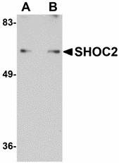 SHOC2 Antibody - Western blot of SHOC2 in Jurkat cell lysate with SHOC2 antibody at (A) 1 and (B) 2 ug/ml. Below: Immunohistochemistry of SHOC2 in human spleen tissue with SHOC2 antibody at 5 ug/ml.