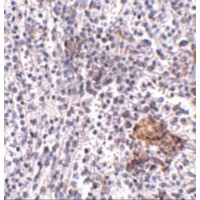 SHOC2 Antibody - Immunohistochemistry of SHOC2 in human spleen tissue with SHOC2 antibody at 5 µg/mL.