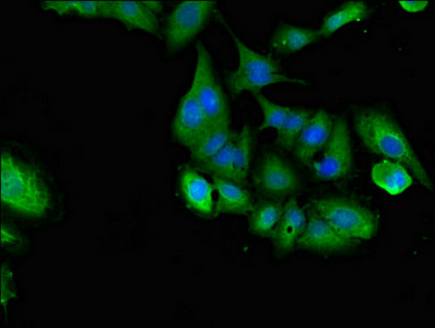 SHOC2 Antibody - Immunofluorescent analysis of Hela cells diluted at 1:100 and Alexa Fluor 488-congugated AffiniPure Goat Anti-Rabbit IgG(H+L)