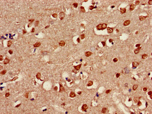 SHOC2 Antibody - Immunohistochemistry of paraffin-embedded human brain tissue at dilution of 1:100