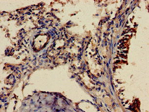 SHOC2 Antibody - Immunohistochemistry of paraffin-embedded human lung tissue at dilution of 1:100