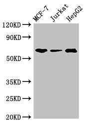 SHOC2 Antibody - Western Blot Positive WB detected in:MCF-7 whole cell lysate,Jurkat whole cell lysate,HepG2 whole cell lysate All Lanes:SHOC2 antibody at 3µg/ml Secondary Goat polyclonal to rabbit IgG at 1/50000 dilution Predicted band size: 65,60 KDa Observed band size: 65 KDa