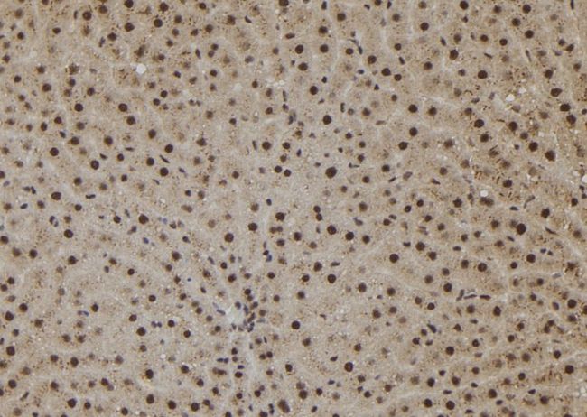 SHOC2 Antibody - 1:100 staining rat liver tissue by IHC-P. The sample was formaldehyde fixed and a heat mediated antigen retrieval step in citrate buffer was performed. The sample was then blocked and incubated with the antibody for 1.5 hours at 22°C. An HRP conjugated goat anti-rabbit antibody was used as the secondary.