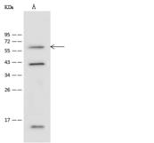 SHOC2 Antibody - Anti-SHOC2 rabbit polyclonal antibody at 1:500 dilution. Lane A: Jurkat Whole Cell Lysate. Lysates/proteins at 30 ug per lane. Secondary: Goat Anti-Rabbit IgG (H+L)/HRP at 1/10000 dilution. Developed using the ECL technique. Performed under reducing conditions. Predicted band size: 65 kDa. Observed band size: 65 kDa.
