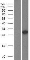 SHOX Protein - Western validation with an anti-DDK antibody * L: Control HEK293 lysate R: Over-expression lysate