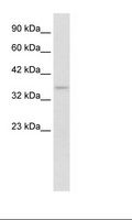 SHOX2 Antibody - Jurkat Cell Lysate.  This image was taken for the unconjugated form of this product. Other forms have not been tested.