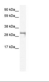 SHOX2 Antibody - Fetal Muscle Lysate.  This image was taken for the unconjugated form of this product. Other forms have not been tested.