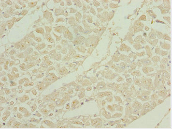 SHOX2 Antibody - Immunohistochemistry of paraffin-embedded human heart tissue at dilution 1:100