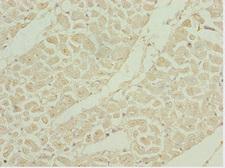 SHOX2 Antibody - Immunohistochemistry of paraffin-embedded human heart tissue at dilution 1:100