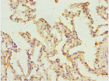 SHOX2 Antibody - Immunohistochemistry of paraffin-embedded human lung tissue at dilution 1:100