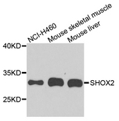 SHOX2 Antibody - Western blot analysis of extract of various cells.