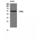 SHPK / CARKL Antibody - Western blot of CARKL antibody