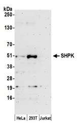SHPK / CARKL Antibody - Detection of human SHPK by western blot. Samples: Whole cell lysate (50 µg) from HeLa, HEK293T, and Jurkat cells prepared using NETN lysis buffer. Antibody: Affinity purified rabbit anti-SHPK antibody used for WB at 1:1000. Detection: Chemiluminescence with an exposure time of 3 minutes.