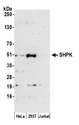 SHPK / CARKL Antibody - Detection of human SHPK by western blot. Samples: Whole cell lysate (50 µg) from HeLa, HEK293T, and Jurkat cells prepared using NETN lysis buffer. Antibody: Affinity purified rabbit anti-SHPK antibody used for WB at 1:1000. Detection: Chemiluminescence with an exposure time of 3 minutes.