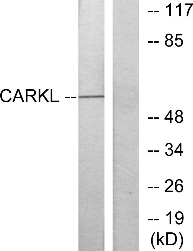 SHPK / CARKL Antibody - Western blot analysis of lysates from Jurkat cells, using CARKL Antibody. The lane on the right is blocked with the synthesized peptide.