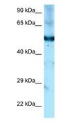 SHPK / CARKL Antibody - SHPK / CARKL antibody Western Blot of Mouse Kidney.  This image was taken for the unconjugated form of this product. Other forms have not been tested.