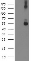 SHPK / CARKL Antibody - HEK293T cells were transfected with the pCMV6-ENTRY control (Left lane) or pCMV6-ENTRY SHPK (Right lane) cDNA for 48 hrs and lysed. Equivalent amounts of cell lysates (5 ug per lane) were separated by SDS-PAGE and immunoblotted with anti-SHPK.