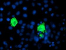 SHPK / CARKL Antibody - Anti-SHPK mouse monoclonal antibody immunofluorescent staining of COS7 cells transiently transfected by pCMV6-ENTRY SHPK.