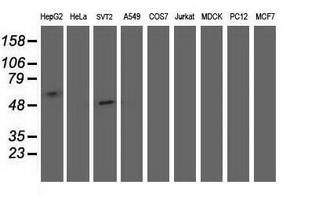 SHPK / CARKL Antibody - Western blot of extracts (35 ug) from 9 different cell lines by using anti-SHPK monoclonal antibody (HepG2: human; HeLa: human; SVT2: mouse; A549: human; COS7: monkey; Jurkat: human; MDCK: canine; PC12: rat; MCF7: human).