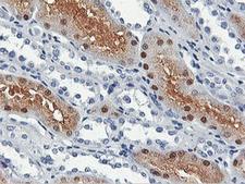 SHPK / CARKL Antibody - IHC of paraffin-embedded Human Kidney tissue using anti-SHPK mouse monoclonal antibody.