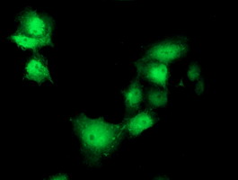 SHPK / CARKL Antibody - Anti-SHPK mouse monoclonal antibody immunofluorescent staining of COS7 cells transiently transfected by pCMV6-ENTRY SHPK.
