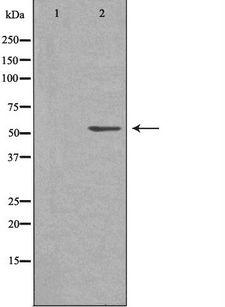SHPK / CARKL Antibody - Western blot analysis of extracts of Jurkat cells using CARKL antibody. The lane on the left is treated with the antigen-specific peptide.