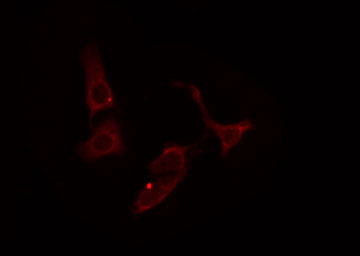 SHPK / CARKL Antibody - Staining HeLa cells by IF/ICC. The samples were fixed with PFA and permeabilized in 0.1% Triton X-100, then blocked in 10% serum for 45 min at 25°C. The primary antibody was diluted at 1:200 and incubated with the sample for 1 hour at 37°C. An Alexa Fluor 594 conjugated goat anti-rabbit IgG (H+L) antibody, diluted at 1/600, was used as secondary antibody.