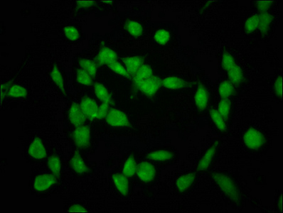SHPRH Antibody - Immunofluorescence staining of SH-SY5Y cells at a dilution of 1:133, counter-stained with DAPI. The cells were fixed in 4% formaldehyde, permeabilized using 0.2% Triton X-100 and blocked in 10% normal Goat Serum. The cells were then incubated with the antibody overnight at 4 °C.The secondary antibody was Alexa Fluor 488-congugated AffiniPure Goat Anti-Rabbit IgG (H+L) .