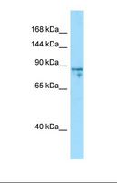 SHROOM1 Antibody - Western blot of Jurkat. CDKL1 antibody dilution 1.0 ug/ml.  This image was taken for the unconjugated form of this product. Other forms have not been tested.