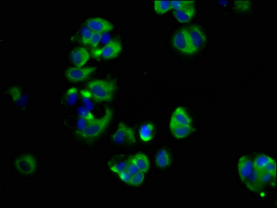 SHROOM2 Antibody - Immunofluorescence staining of MCF-7 cells at a dilution of 1:66, counter-stained with DAPI. The cells were fixed in 4% formaldehyde, permeabilized using 0.2% Triton X-100 and blocked in 10% normal Goat Serum. The cells were then incubated with the antibody overnight at 4 °C.The secondary antibody was Alexa Fluor 488-congugated AffiniPure Goat Anti-Rabbit IgG (H+L) .