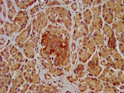 SHROOM2 Antibody - IHC image of SHROOM2 Antibody diluted at 1:200 and staining in paraffin-embedded human pancreatic tissue performed on a Leica BondTM system. After dewaxing and hydration, antigen retrieval was mediated by high pressure in a citrate buffer (pH 6.0). Section was blocked with 10% normal goat serum 30min at RT. Then primary antibody (1% BSA) was incubated at 4°C overnight. The primary is detected by a biotinylated secondary antibody and visualized using an HRP conjugated SP system.