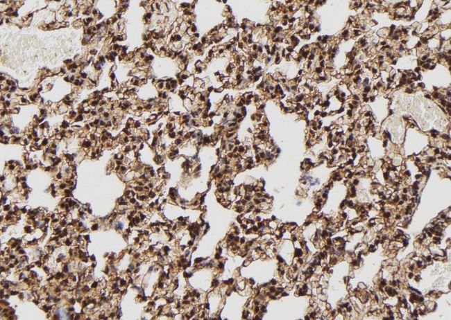 SHSF1 / SHFM1 Antibody - 1:100 staining rat lung tissue by IHC-P. The sample was formaldehyde fixed and a heat mediated antigen retrieval step in citrate buffer was performed. The sample was then blocked and incubated with the antibody for 1.5 hours at 22°C. An HRP conjugated goat anti-rabbit antibody was used as the secondary.