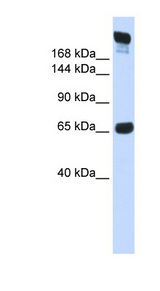 SI / Sucrase Isomaltase Antibody - SI / Alpha-Glucosidase antibody Western blot of Fetal Muscle lysate. This image was taken for the unconjugated form of this product. Other forms have not been tested.