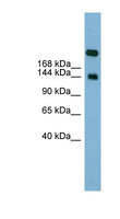 SI / Sucrase Isomaltase Antibody - SI / Alpha-Glucosidase antibody Western blot of Fetal Small Intestine lysate. This image was taken for the unconjugated form of this product. Other forms have not been tested.
