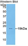 SI / Sucrase Isomaltase Antibody - Western blot of recombinant SI / Alpha-Glucosidase.  This image was taken for the unconjugated form of this product. Other forms have not been tested.