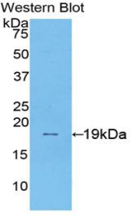 SI / Sucrase Isomaltase Antibody - Western blot of recombinant SI / Alpha-Glucosidase.  This image was taken for the unconjugated form of this product. Other forms have not been tested.