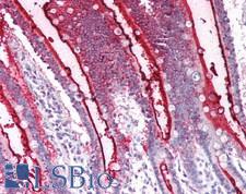 SI / Sucrase Isomaltase Antibody - Human Small Intestine: Formalin-Fixed, Paraffin-Embedded (FFPE)