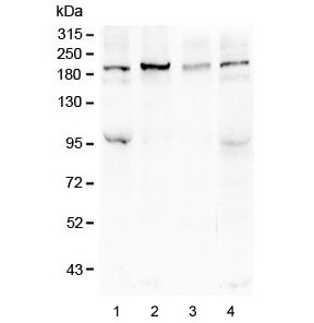 SI / Sucrase Isomaltase Antibody - Western blot testing of human 1) HeLa, 2) COLO-320, 3) SHG-44 and 4) HEK293 lysate with Sucrase Isomaltase antibody at 0.5ug/ml. Predicted molecular weight ~209 kDa.