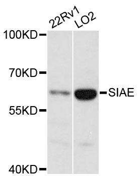 SIAE Antibody - Western blot analysis of extracts of various cell lines, using SIAE antibody at 1:3000 dilution. The secondary antibody used was an HRP Goat Anti-Rabbit IgG (H+L) at 1:10000 dilution. Lysates were loaded 25ug per lane and 3% nonfat dry milk in TBST was used for blocking. An ECL Kit was used for detection and the exposure time was 1s.