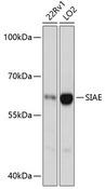 SIAE Antibody - Western blot analysis of extracts of various cell lines using SIAE Polyclonal Antibody at dilution of 1:3000.
