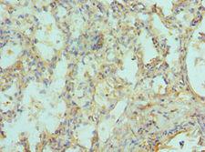SIAH1 Antibody - Immunohistochemistry of paraffin-embedded human lung using antibody at 1:100 dilution.