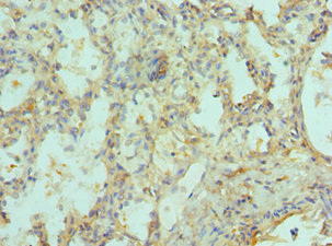 SIAH1 Antibody - Immunohistochemistry of paraffin-embedded human lung tissue using SIAH1 Antibody at dilution of 1:100