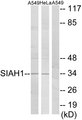 SIAH1 Antibody - Western blot analysis of lysates from A549 and HeLa cells, using SIAH1 Antibody. The lane on the right is blocked with the synthesized peptide.