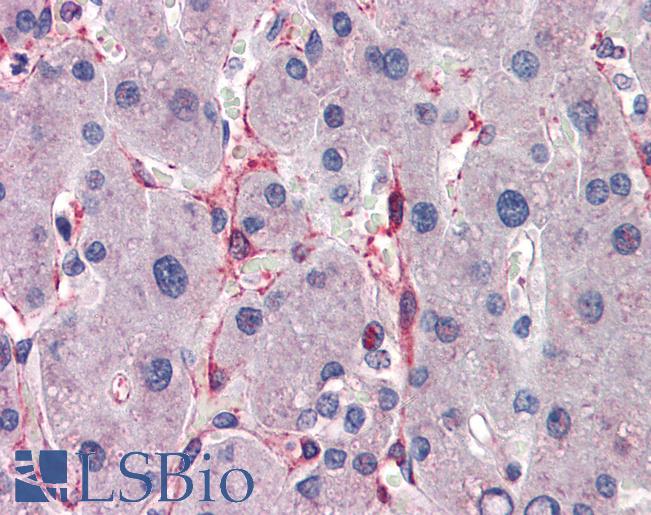 SIAH1 Antibody - Anti-SIAH1 antibody IHC of human liver. Immunohistochemistry of formalin-fixed, paraffin-embedded tissue after heat-induced antigen retrieval. Antibody concentration 5 ug/ml.  This image was taken for the unconjugated form of this product. Other forms have not been tested.