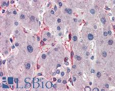 SIAH1 Antibody - Anti-SIAH1 antibody IHC of human liver. Immunohistochemistry of formalin-fixed, paraffin-embedded tissue after heat-induced antigen retrieval. Antibody concentration 5 ug/ml.  This image was taken for the unconjugated form of this product. Other forms have not been tested.