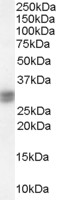 SIAH1 Antibody - SIAH1 antibody staining (0.1 ug/ml) of Human Liver lysate (RIPA buffer, 30g total protein per lane). Primary incubated for 1 hour. Detected by Western blot of chemiluminescence.