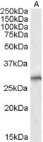 SIAH1 Antibody - Staining (1?g/ml) of Human Liver lysate (RIPA buffer, 35?g total protein per lane). Detected by chemiluminescence.